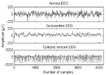 rEEGard (robust algorithm for EEG-based automated seizure diagnosis)